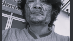 Viral, Korban Dugaan Pengeroyokan di Nias Selatan Laporkan Para Pelaku