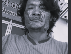 Viral, Korban Dugaan Pengeroyokan di Nias Selatan Laporkan Para Pelaku