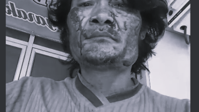 Viral, Korban Dugaan Pengeroyokan di Nias Selatan Laporkan Para Pelaku
