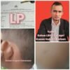 Orang Tua Laporkan Dugaan Kekerasan terhadap Anak ke Posek Bengkong, Mediasi dengan Pihak Terlapor Disebut Buntu